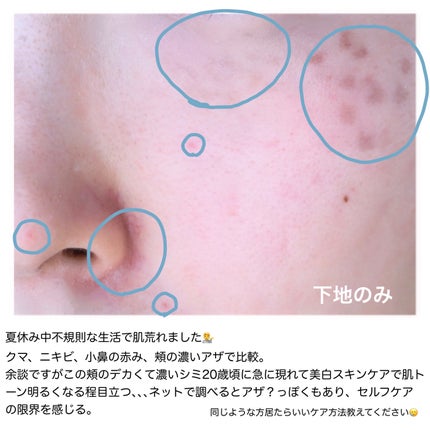 &be ファンシーラー/&be/パレットコンシーラーを使ったクチコミ(2枚目)