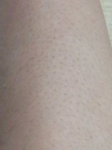 除毛クリーム シトラスホワイトリリィ/スリンキータッチ セルフスパ/除毛クリームを使ったクチコミ(1枚目)