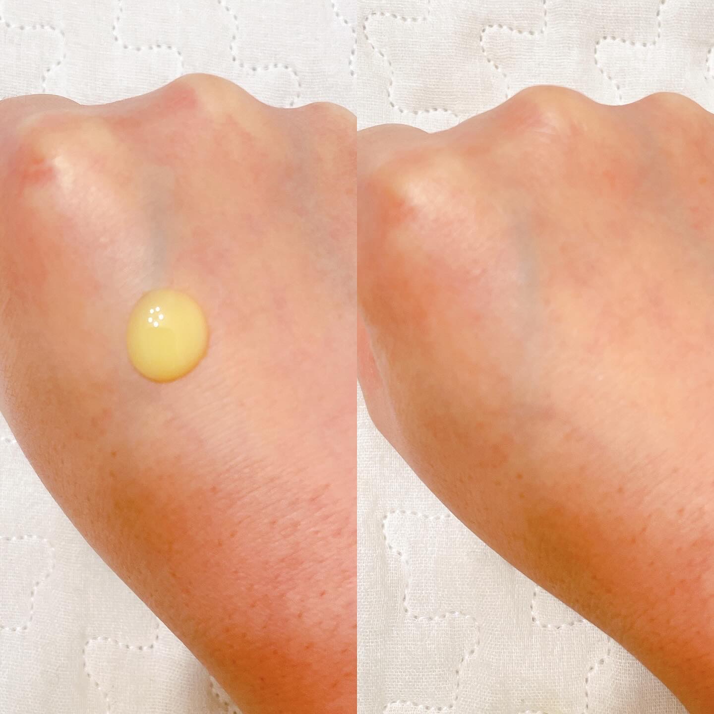 ハイパー レチノールEX 1.0セラム/Isntree/美容液を使ったクチコミ（2枚目）