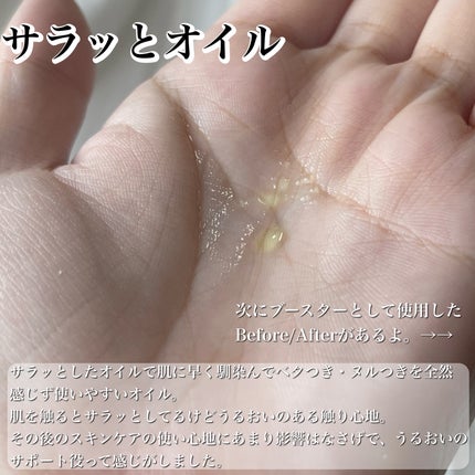 ミミチュール マイ グロウ オイル/クラブ/ブースター・導入液を使ったクチコミ(6枚目)