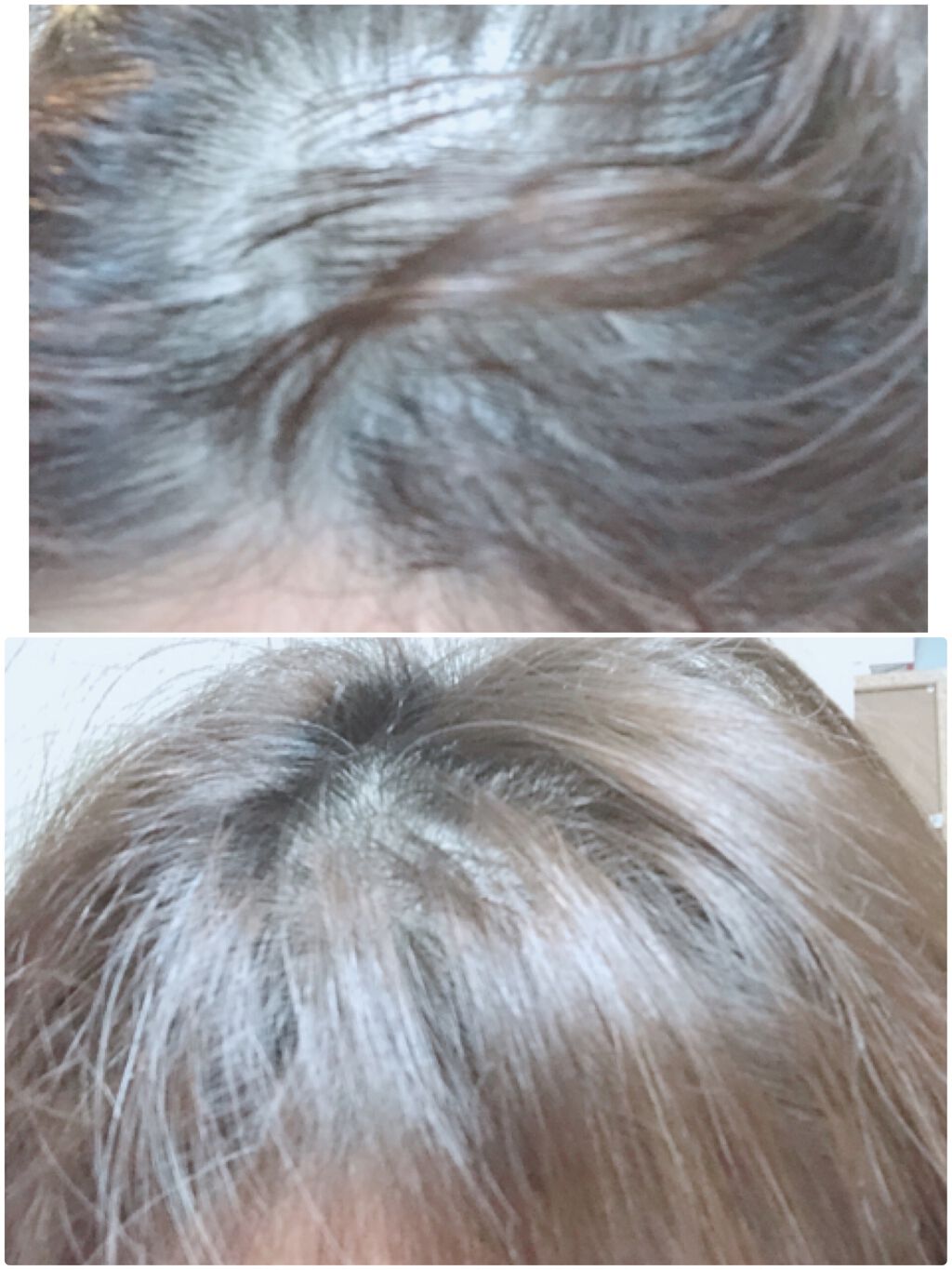 薬用スカルプエッセンス/HAIRICHE/頭皮ローションを使ったクチコミ(5枚目)