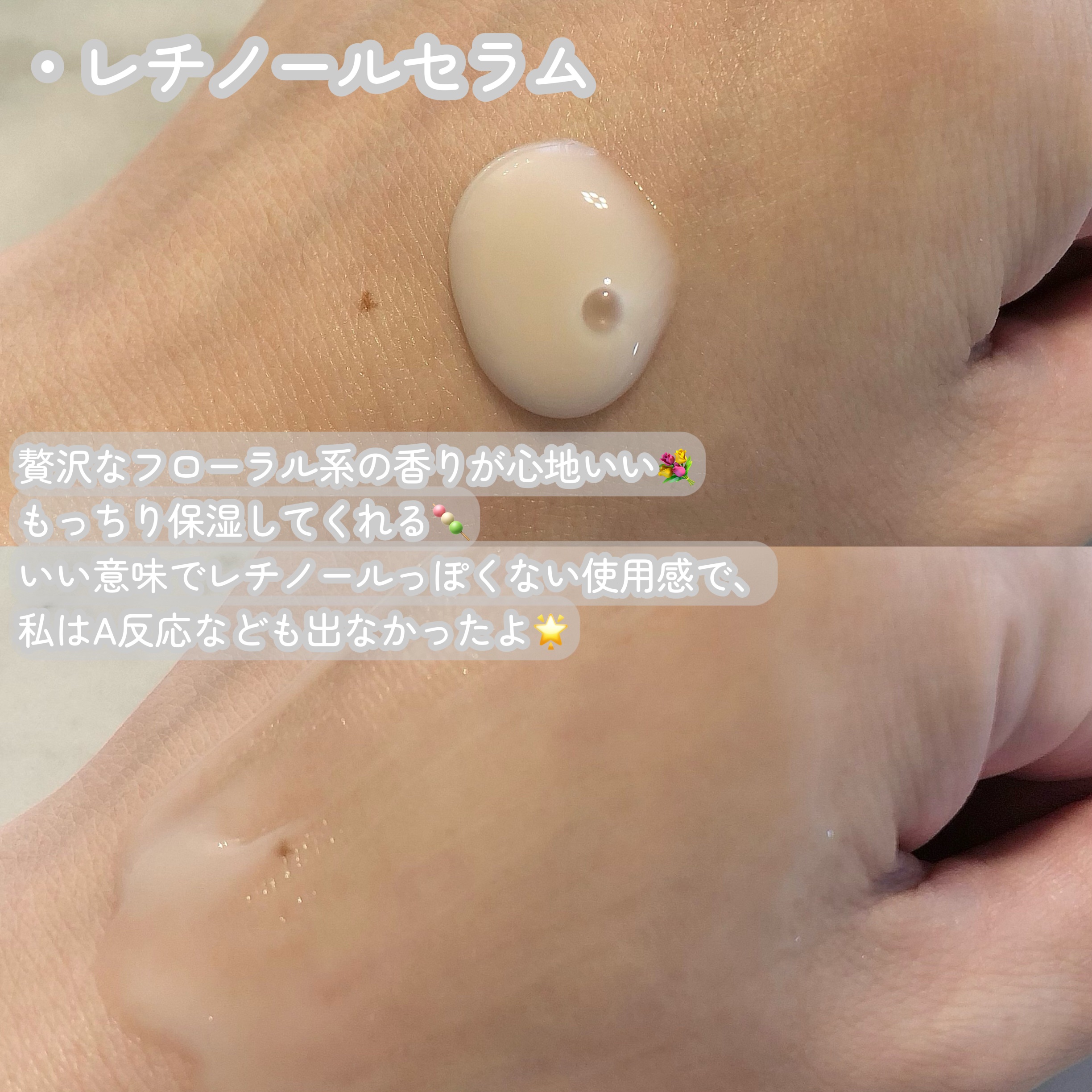 ブラックスネイル クリーム/Dr.G/フェイスクリームを使ったクチコミ（3枚目）