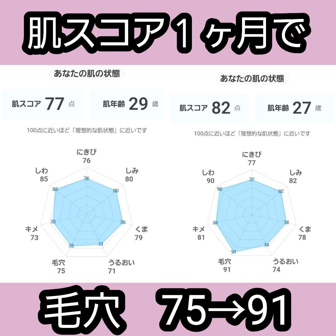 薬用しみ対策 美白化粧水 しっとりタイプ/メラノCC/化粧水を使ったクチコミ（1枚目）