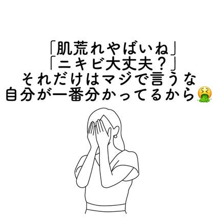 おゆみ|ニキビ・ニキビ跡ケア on LIPS 「【猛烈ニキビに悩んだ女子&悩み中の女子に捧げる!】わか..」(7枚目)