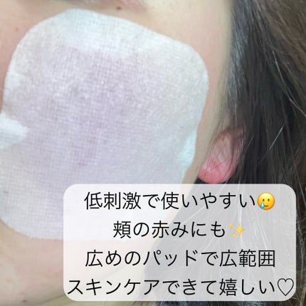 マデカソサイド ブレミッシュパッド/MEDIHEAL/トナーパッドを使ったクチコミ(2枚目)