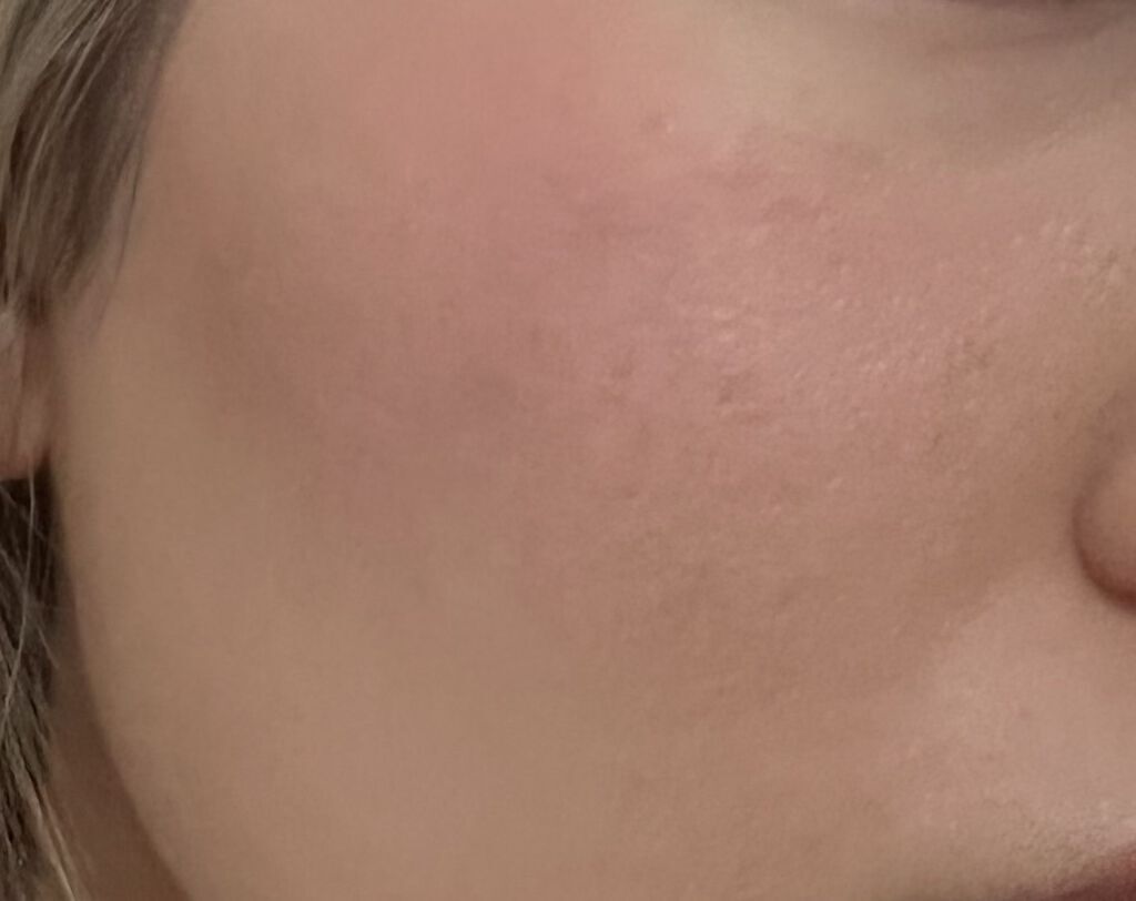 ベアブラッシャー パフ付き/フォレンコス/パウダーチークを使ったクチコミ（3枚目）