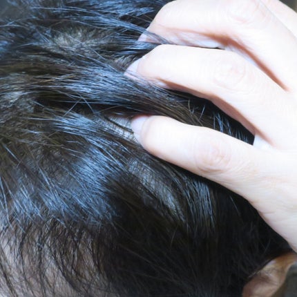 いちごみるく on LIPS 「女性の薄毛の原因に着目したスカルプ専用の頭皮エッセンスリデニカ..」(5枚目)