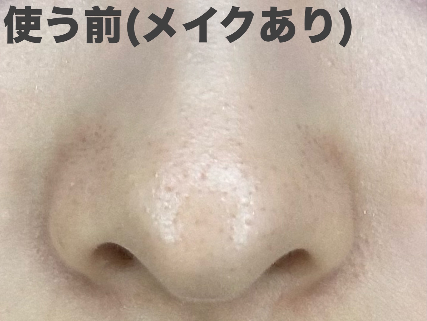 パーフェクトワンフォーカス スムースクレンジングバーム ディープブラック クロミ 限定デザイン（75g）/PERFECT ONE  FOCUS/クレンジングバームを使ったクチコミ（2枚目）