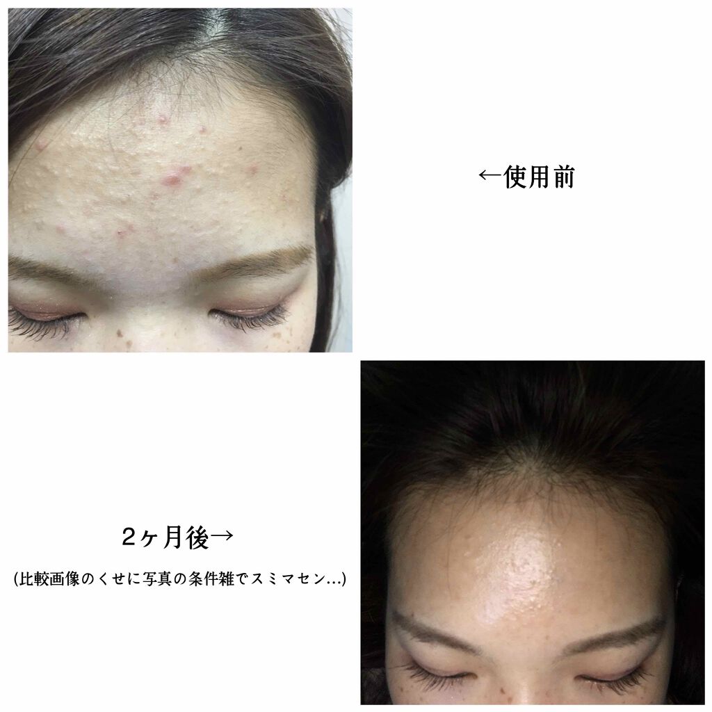 ツナだいすき on LIPS 「"みるだけ"のLIPSは卒業するぞォー!!という意気込みで始ま..」(2枚目)