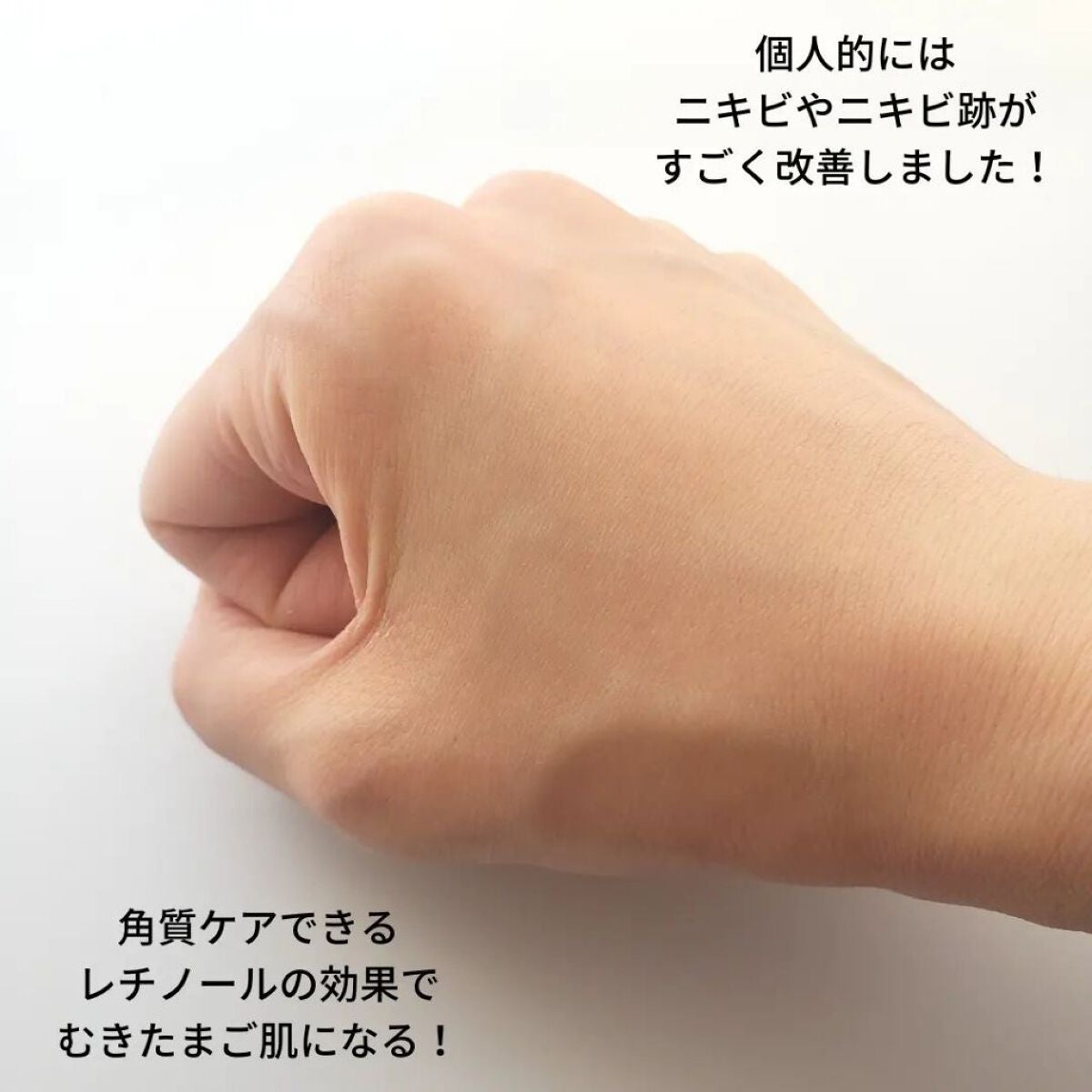 レチノール シカ リペア セラム/innisfree/美容液を使ったクチコミ(3枚目)