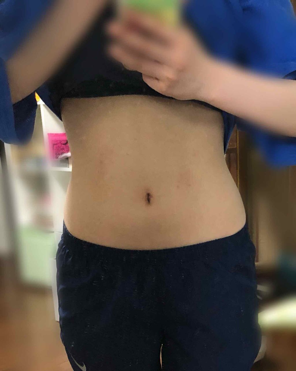 寝ながらメディキュット スパッツ 骨盤テーピング/メディキュット/着圧ソックス・レギンスを使ったクチコミ（3枚目）