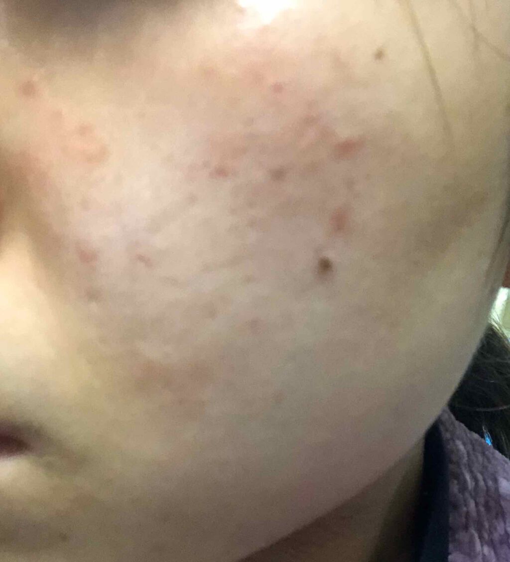 アルビオン 薬用スキンコンディショナー エッセンシャル/ALBION/化粧水を使ったクチコミ(2枚目)