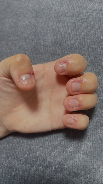 甘皮ケアオイル/無印良品/ネイルオイル・トリートメントを使ったクチコミ(2枚目)