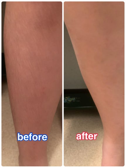 パイナップル豆乳除毛クリーム/鈴木ハーブ研究所/除毛クリームを使ったクチコミ(2枚目)