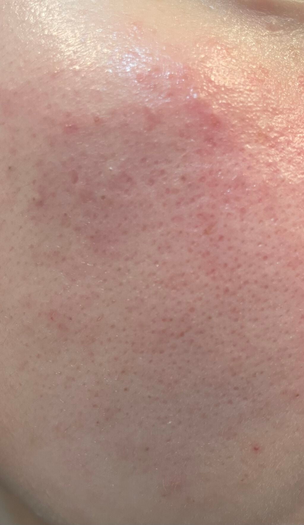 デュオ ザ クレンジングバーム クリア/DUO/クレンジングバームを使ったクチコミ(3枚目)