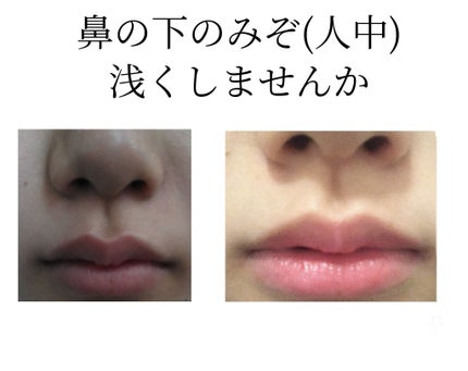 ハトムギオールインワンゲル/プラチナレーベル/オールインワン化粧品を使ったクチコミ(1枚目)