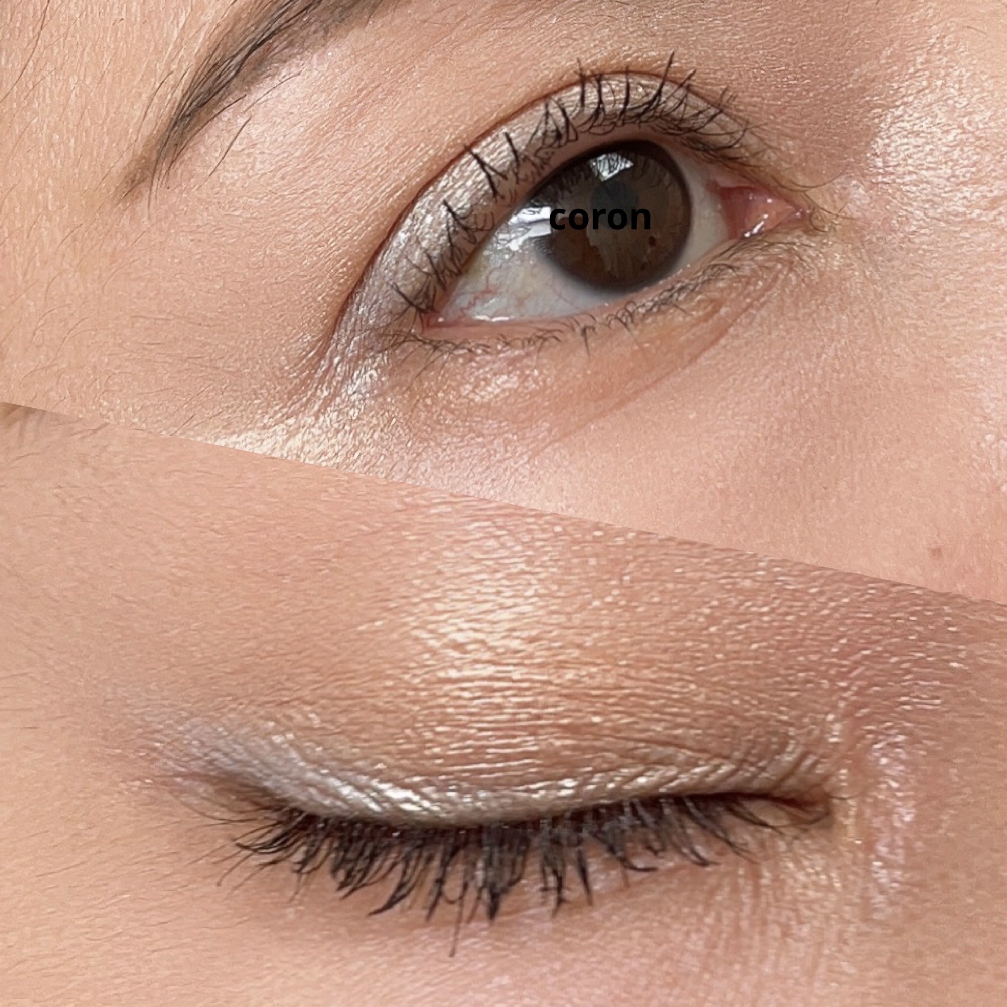 ラディアント タッチ/YVES SAINT LAURENT BEAUTE/リキッドコンシーラーを使ったクチコミ（2枚目）