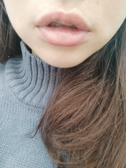 リップバターバーム/ASUNE /リップケアを使ったクチコミ(4枚目)