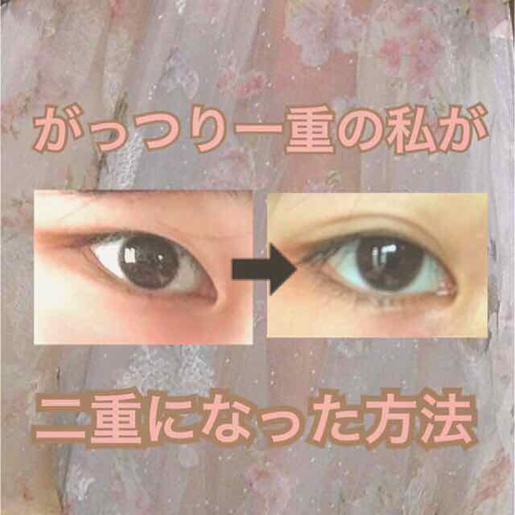 アイトーク/アイトーク/二重まぶた用アイテムを使ったクチコミ（1枚目）
