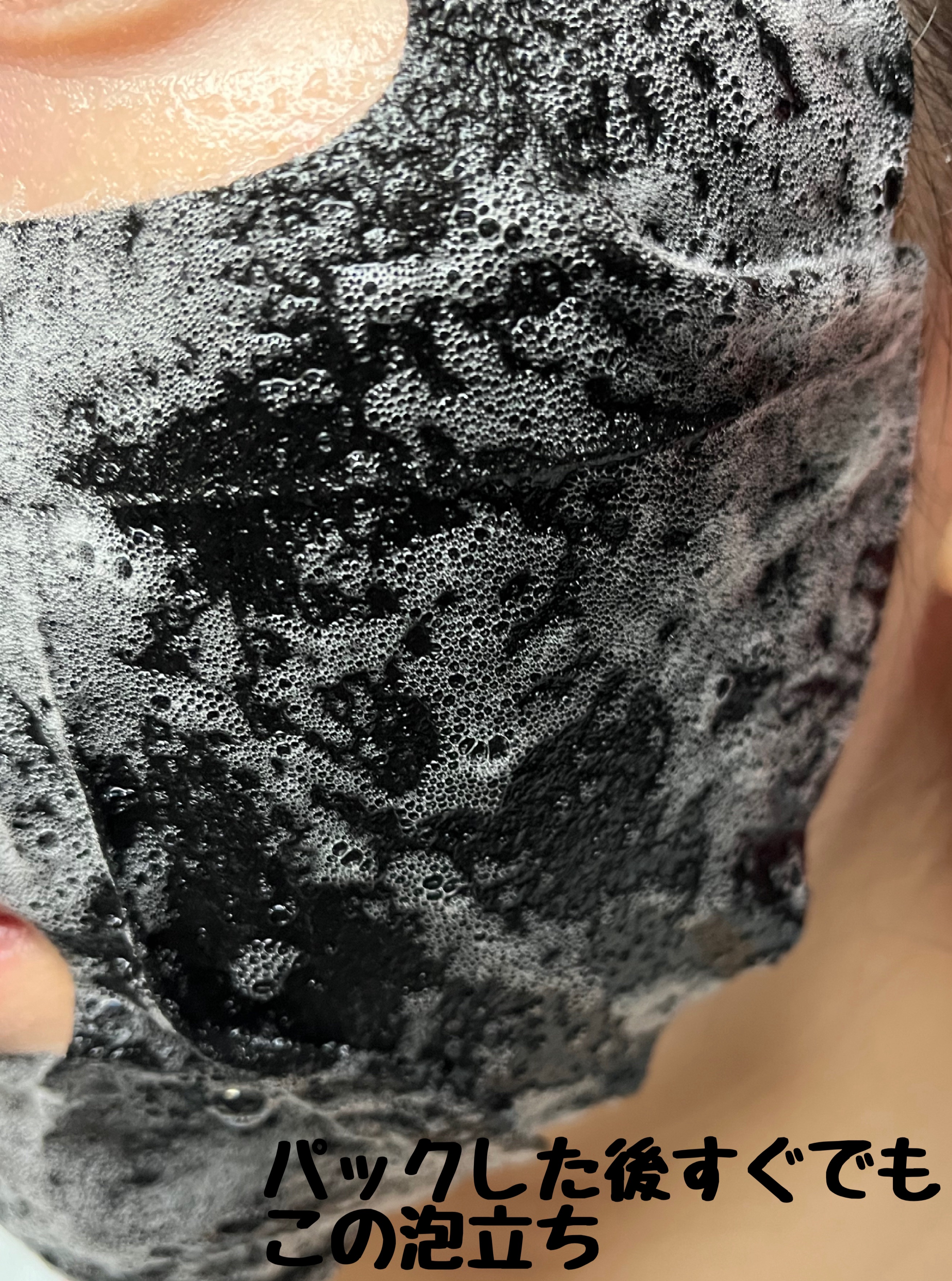 セルフエステティック ポアクリーンバブル マスク/G9SKIN/洗い流すパック・マスクを使ったクチコミ（2枚目）