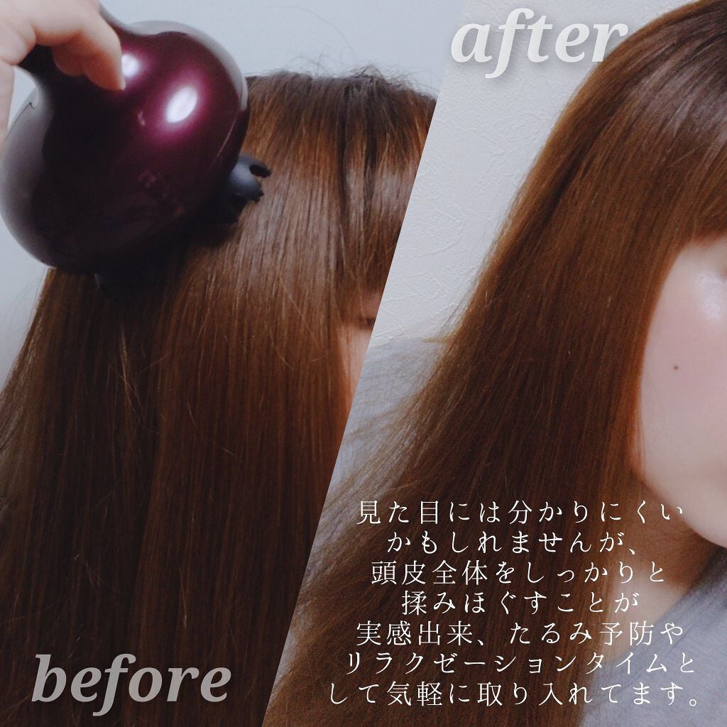 ルメント ヘッドスパ/Le ment/ヘッドマッサージャーを使ったクチコミ(9枚目)