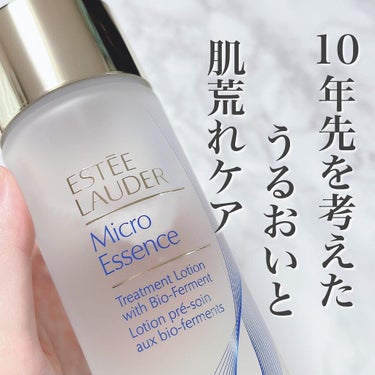 マイクロ エッセンス ローション BF/ESTEE LAUDER/化粧水を使ったクチコミ（1枚目）