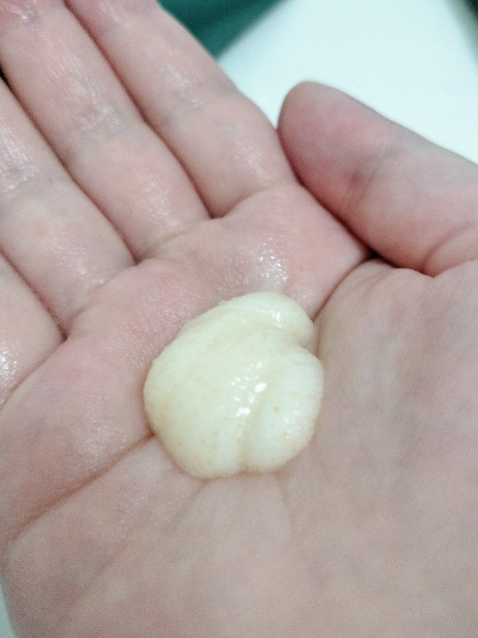 カロテンクーリングスケーラー/treecell/頭皮クレンジングを使ったクチコミ（3枚目）