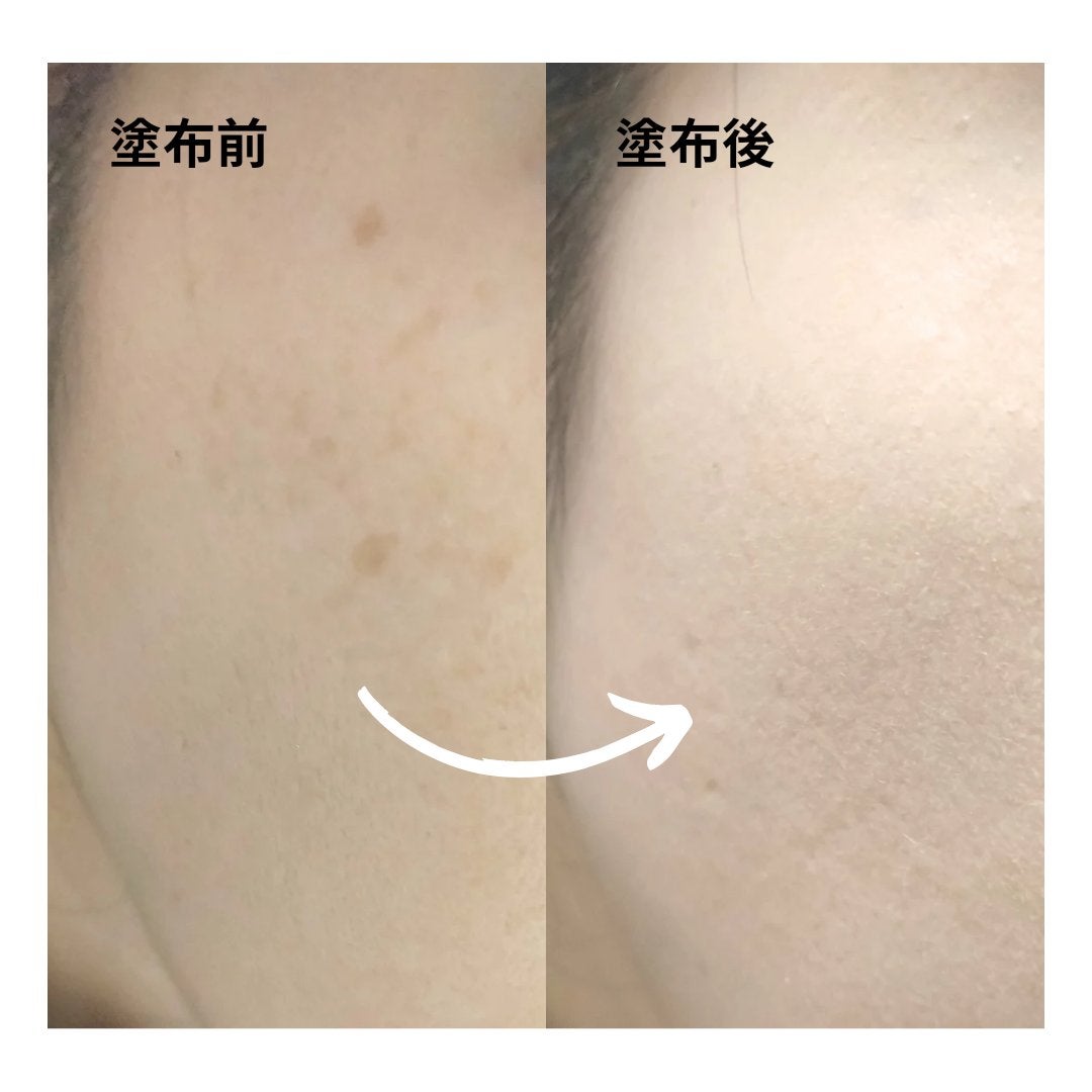 ダーマシンコンシーラー/23years old/リキッドコンシーラーを使ったクチコミ(6枚目)