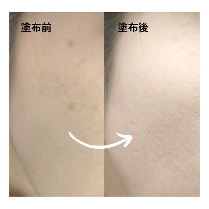 ダーマシンコンシーラー/23years old/リキッドコンシーラーを使ったクチコミ(6枚目)