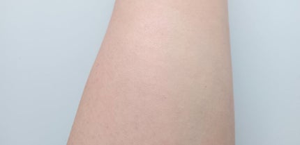 イプノス シーバムクリア リペアセラム/ACSEINE/美容液を使ったクチコミ(5枚目)