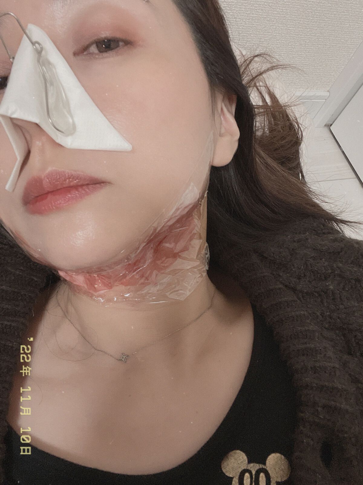 AHA 30% + BHA 2% Peeling Solution/The Ordinary/ピーリングを使ったクチコミ(1枚目)