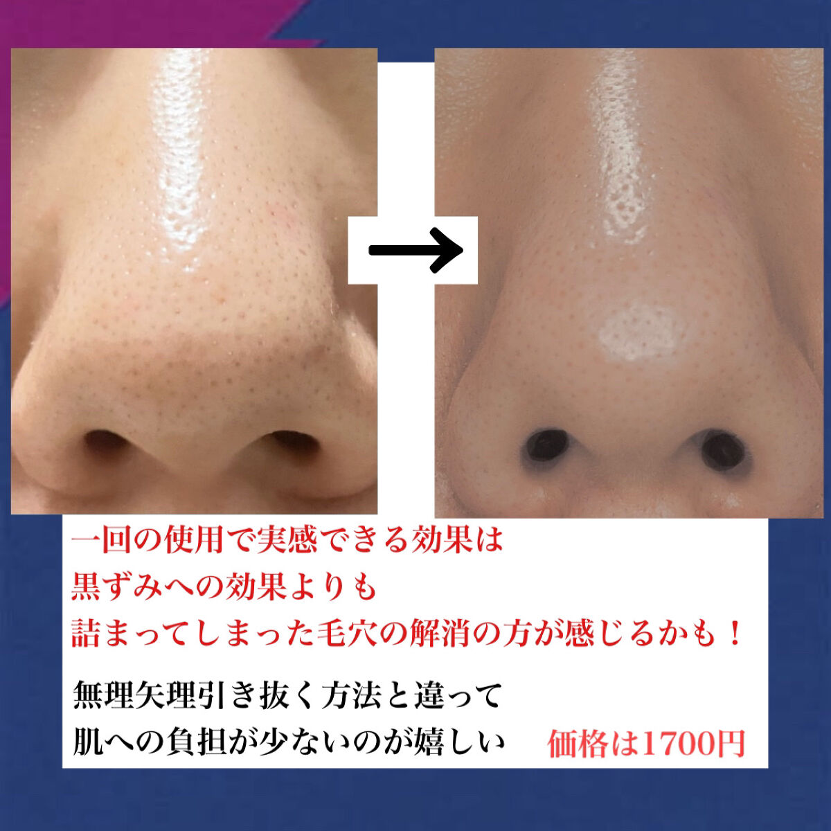 ノーモアブラックヘッド(ノーズピーリング)/One-day's you/スクラブ・ゴマージュを使ったクチコミ（3枚目）