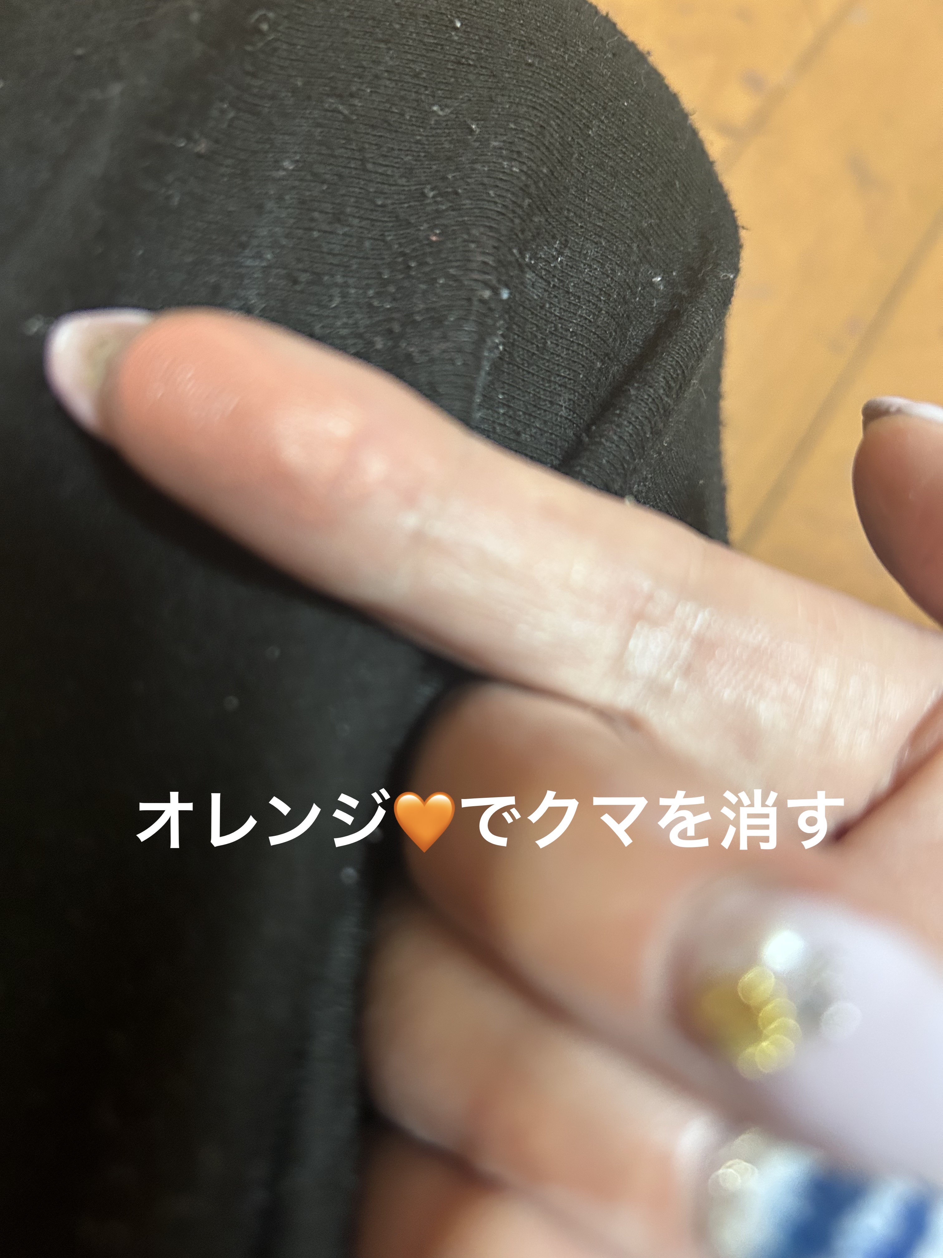 リシェ レッドトリック アイコンシーラー/Visée/パレットコンシーラーを使ったクチコミ（3枚目）