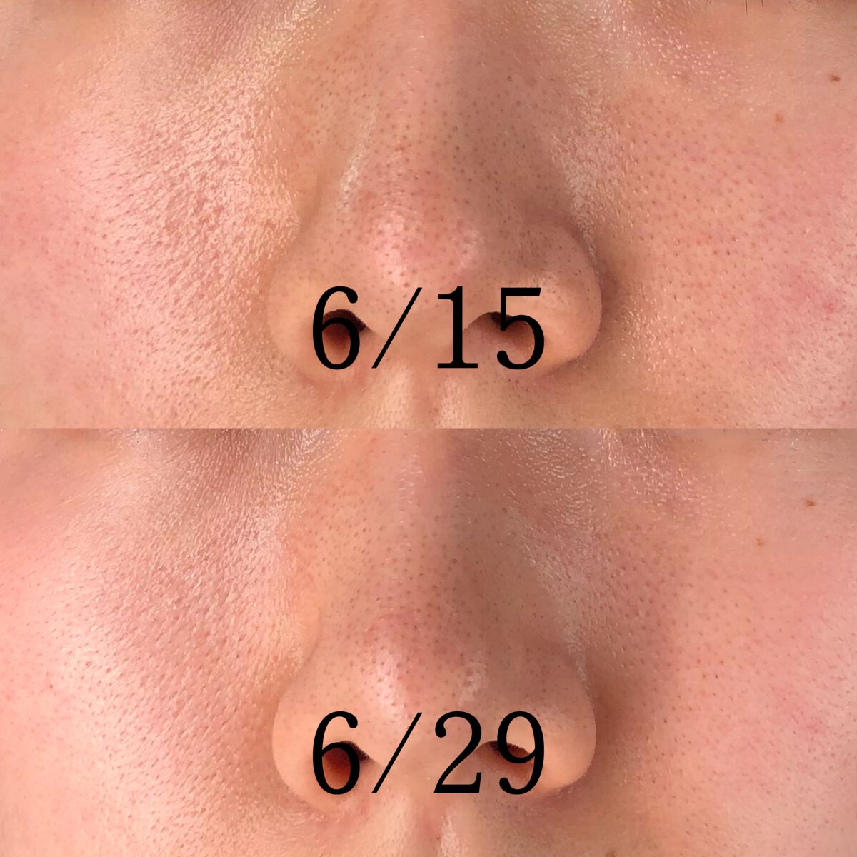 アンブリオリス モイスチャークリーム/アンブリオリス/フェイスクリームを使ったクチコミ（2枚目）