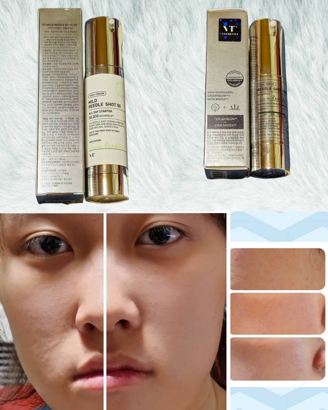 マイルドリードルショット50/VT/美容液を使ったクチコミ(2枚目)