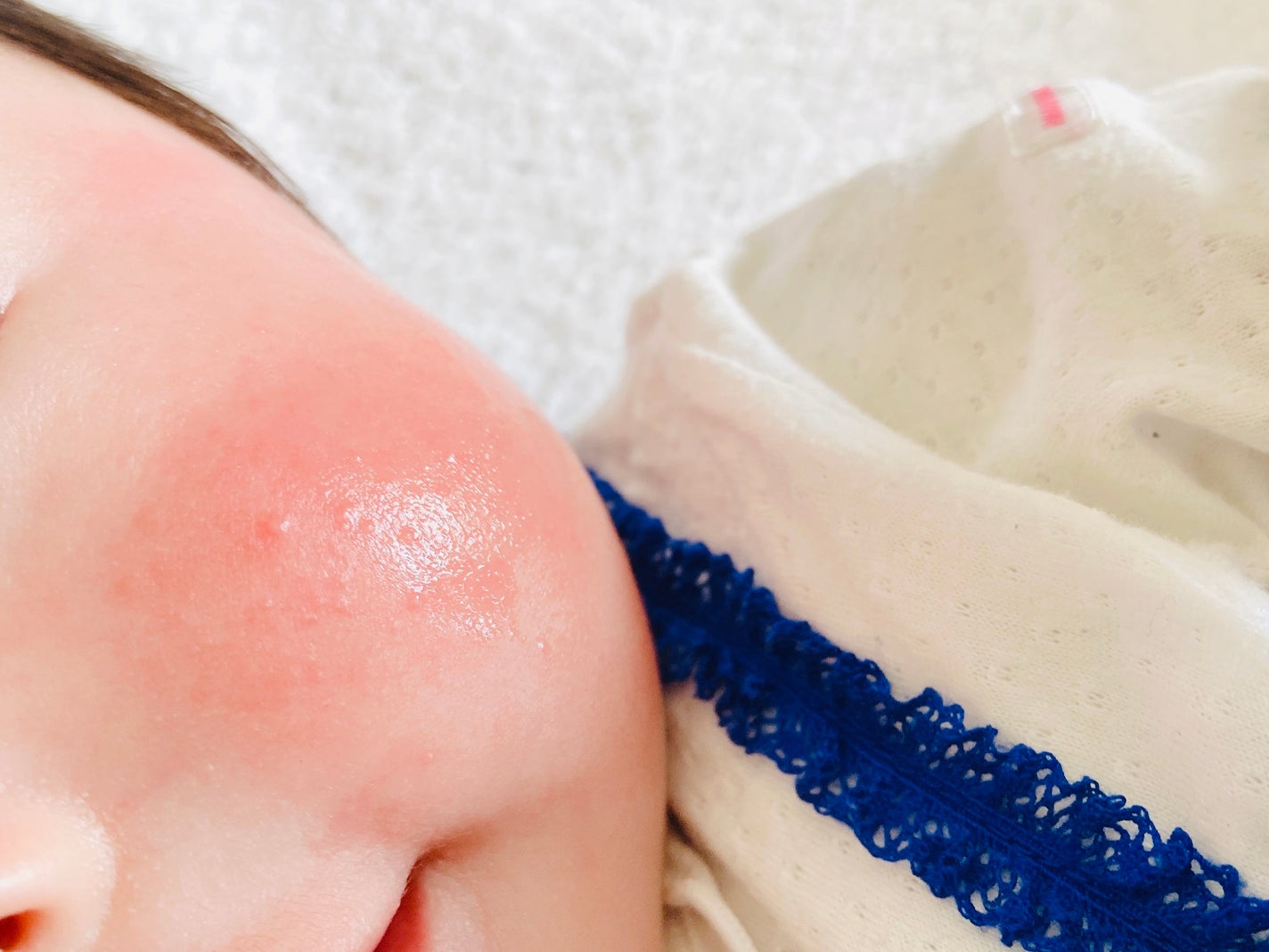 ベビーマトリックスF/シェルシュール/美容液を使ったクチコミ(5枚目)