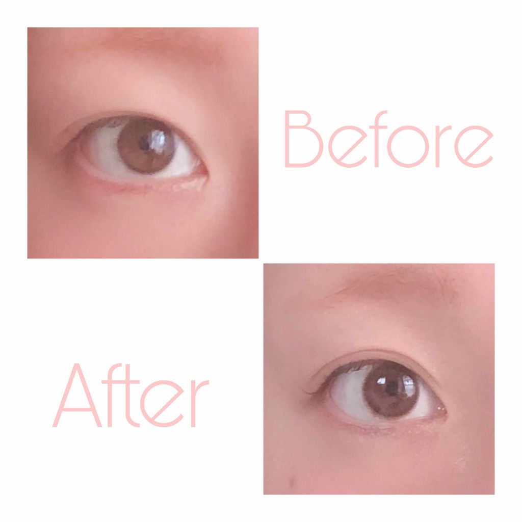 ナイトアイボーテ/StreeTrend/二重まぶた用アイテムを使ったクチコミ(2枚目)