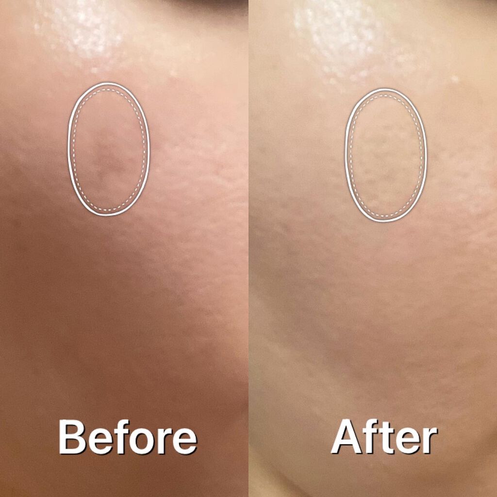 フィニッシングパウダー マット/チャコット・コスメティクス/ルースパウダーを使ったクチコミ(7枚目)