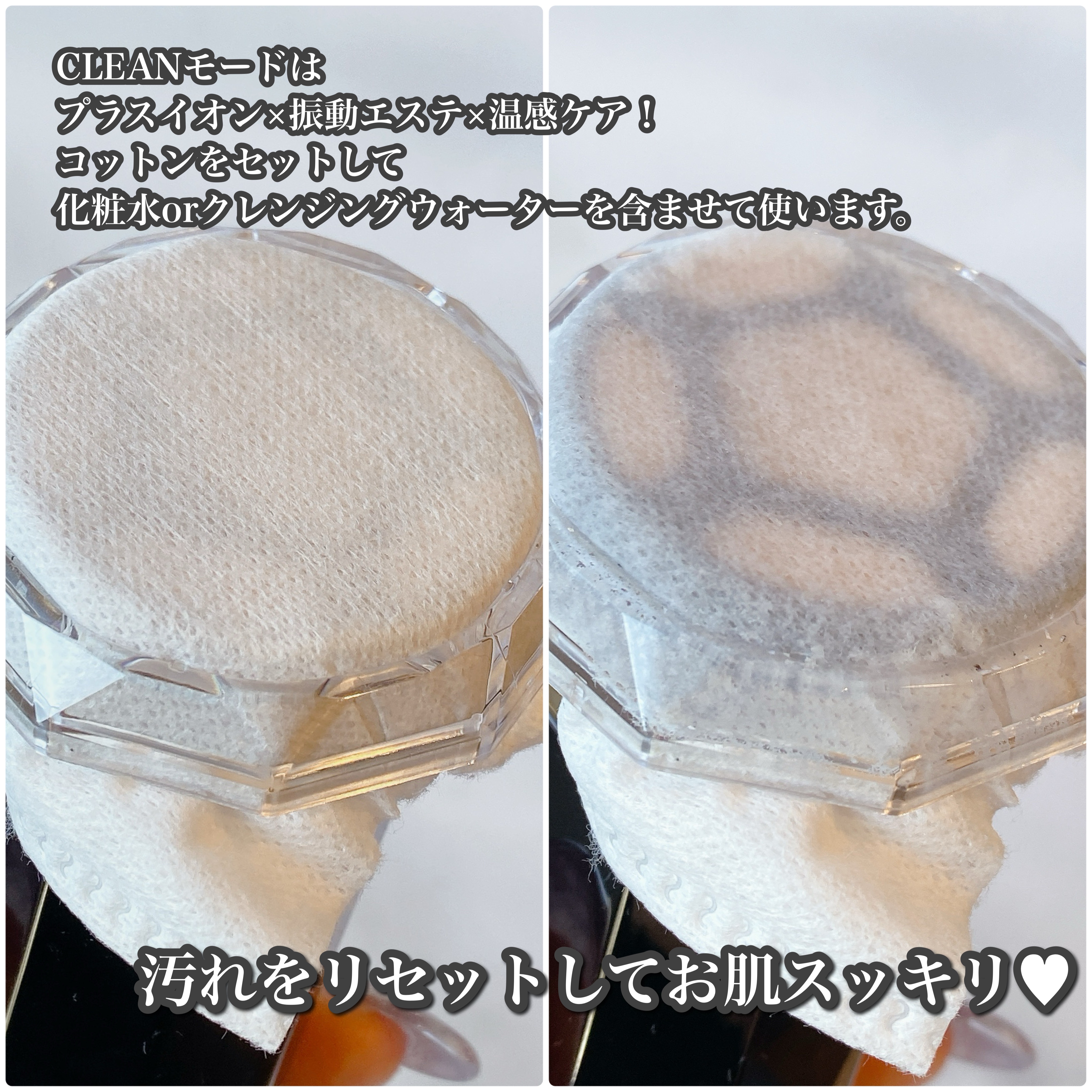 RF温冷美顔器PRO/ANLAN/美顔器・マッサージを使ったクチコミ（3枚目）