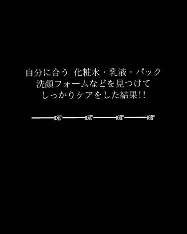 パーフェクトホイップ コラーゲンin/SENKA（専科）/洗顔フォームを使ったクチコミ（3枚目）