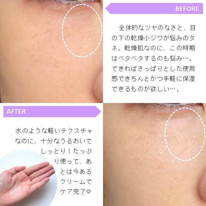 F. Skin Toner/Ferne/化粧水を使ったクチコミ（2枚目）