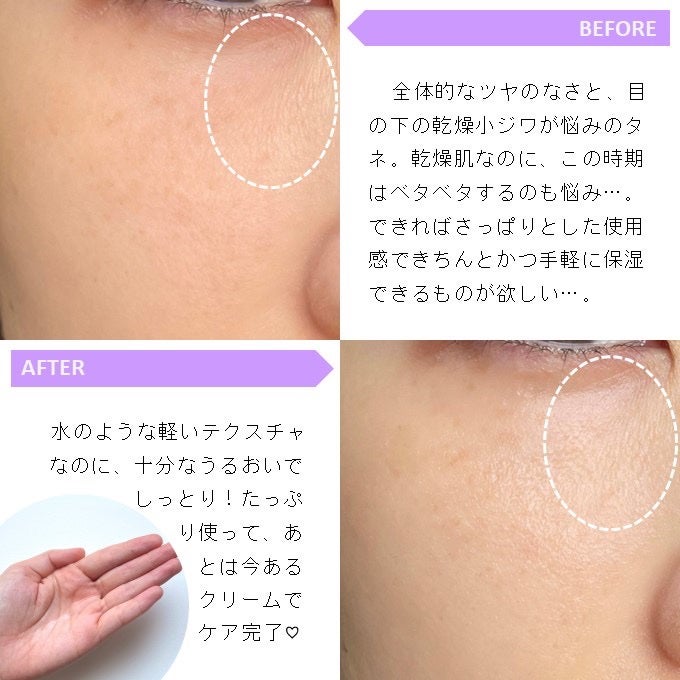 F. Skin Toner/Ferne/化粧水を使ったクチコミ(2枚目)