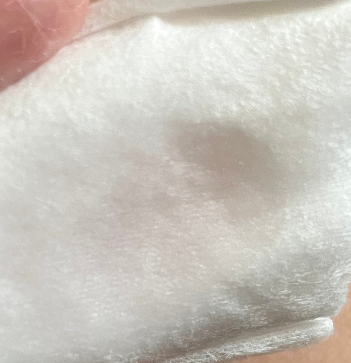 ピンクティーツリートナー/APLIN/化粧水を使ったクチコミ(3枚目)