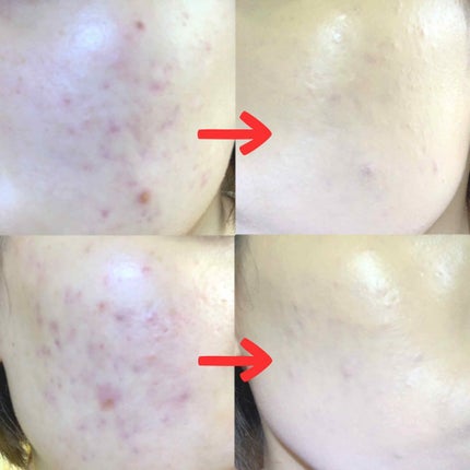 キル カバー ファンウェア クッション エックスピー/CLIO/クッションファンデーションを使ったクチコミ(2枚目)