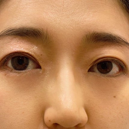 GENISH/株式会社ビューフロンティア/カラーコンタクトレンズを使ったクチコミ(4枚目)