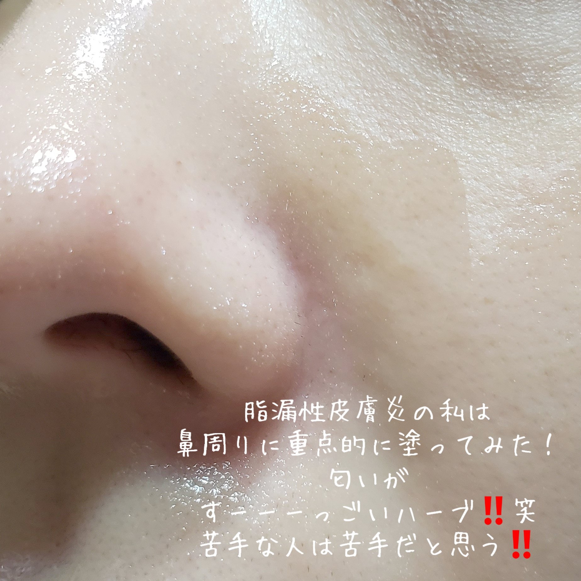 アクネウォッシュ23アンプル/Feld Apotheke/美容液を使ったクチコミ（3枚目）