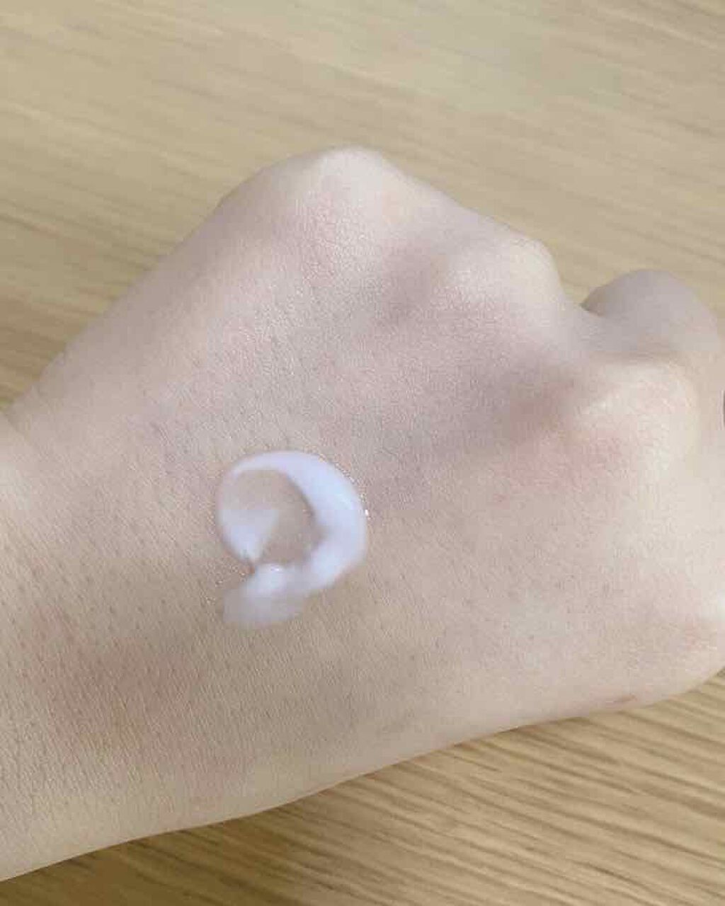 カユピット（医薬品）/メンソレータム/その他を使ったクチコミ（3枚目）