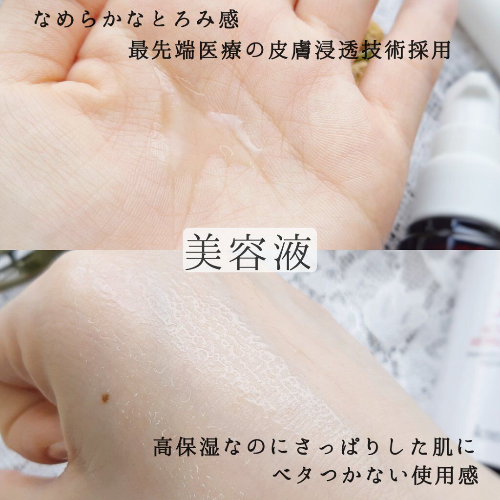 薬用Rエッセンス/HIN アクネスラボ/美容液を使ったクチコミ(4枚目)