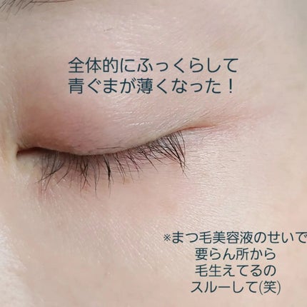 ちょこ on LIPS 「前回の投稿から2週間スネコス2回目行ってきました❗..」(4枚目)