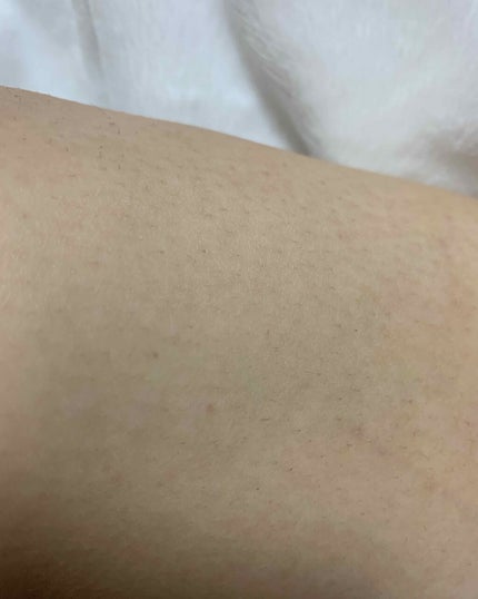 ボタニカルズ 除毛クリーム 敏感肌用/Veet/除毛クリームを使ったクチコミ(3枚目)